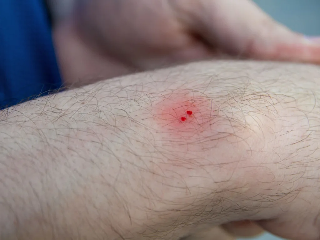 First-Aid 101: Animal Scratches and Bites
